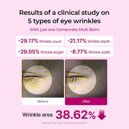 Dr. Monexis Cemenrete Calcium Multi Balm