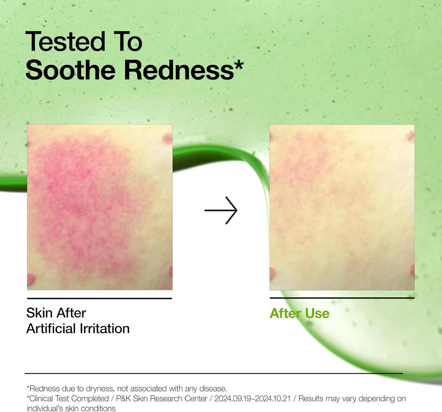 Azelaic Acid 10 Hyaluron Redness Soothing Serum