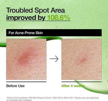 Azelaic Acid 10 Hyaluron Redness Soothing Serum