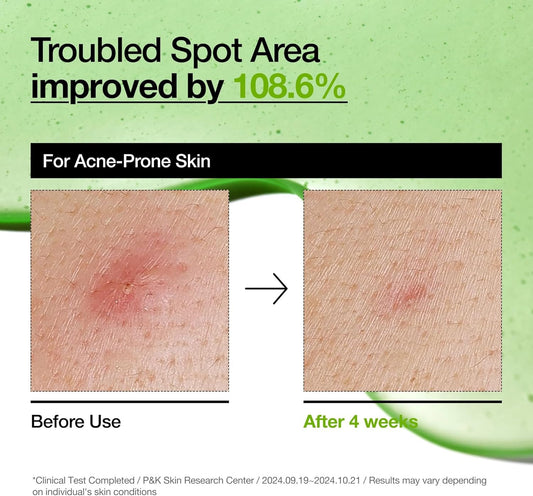 Azelaic Acid 10 Hyaluron Redness Soothing Serum